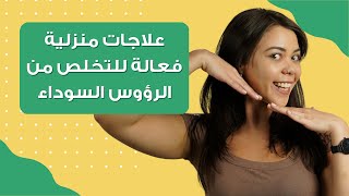 3 علاجات منزلية سهلة وفعالة تخلصك من الرؤوس السوداء