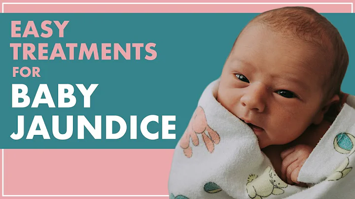 BABY JAUNDICE | Treating JAUNDICE In Babies From HOME - DayDayNews