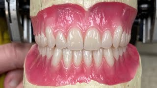 Live: Complete denture try in