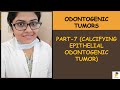 Calcifying Epithelial Odontogenic Tumor CEOT Oral Pathology For BDS MDS Students Aspirants Calcifying Epithelial Odontogenic Tumor CEOT Oral Pathology For BDS MDS Students Aspirants