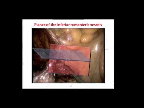 Critical anatomy relationships: the key to successful surgery