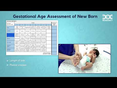 Gestational Age Assessment for Newborns | Newborn Baby Scoring System Explained