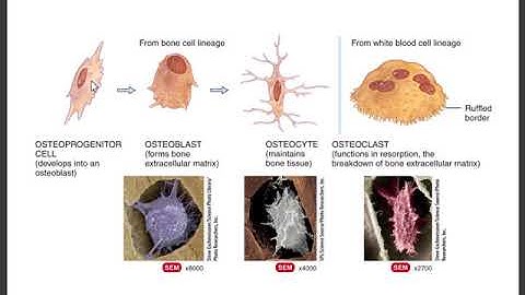 Chapter 6 Bones and Bone Structure Part 2