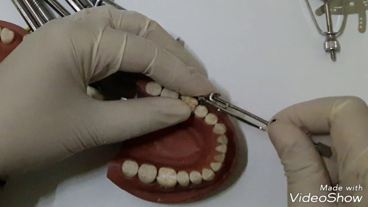 طريقة تطبيق مسندة mod