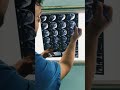 RECURRENT SHOULDER DISLOCATION SURGERY : BANKART REPAIR AND REMPLISSAGE PROCEDURE by Dr Abhishek