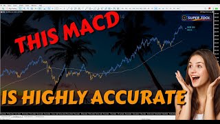 Best MACD Indicator Setup: Highly Accurate MACD Setup!!