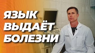 картинка: Что язык говорит о вашем здоровье