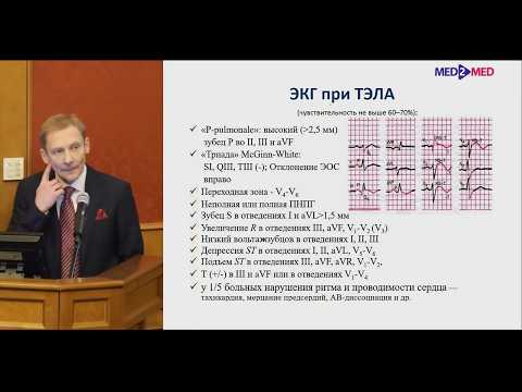 Диагностика и лечение ТЭЛА Гаврилов Ю.В.