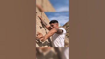 Thumbnail of WHAT HAPPENED TO YOUR ARM? 😱
