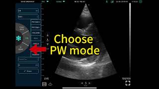 How to use MY USG(V1.0.23) to measure VTI screenshot 2