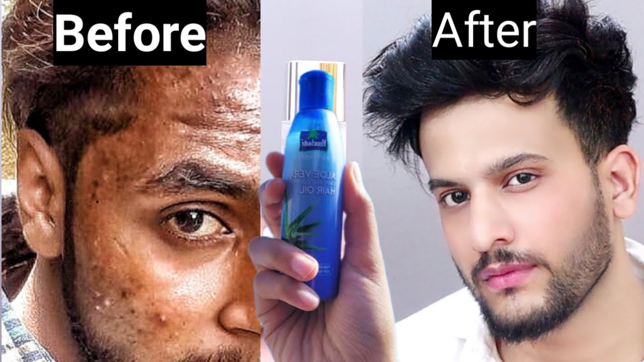 Winter Skin Care Tips For Boys In HindiSkin care Tips for Men in Hindi