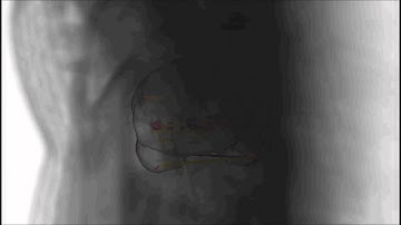 Fetal MRI maps developing brain function