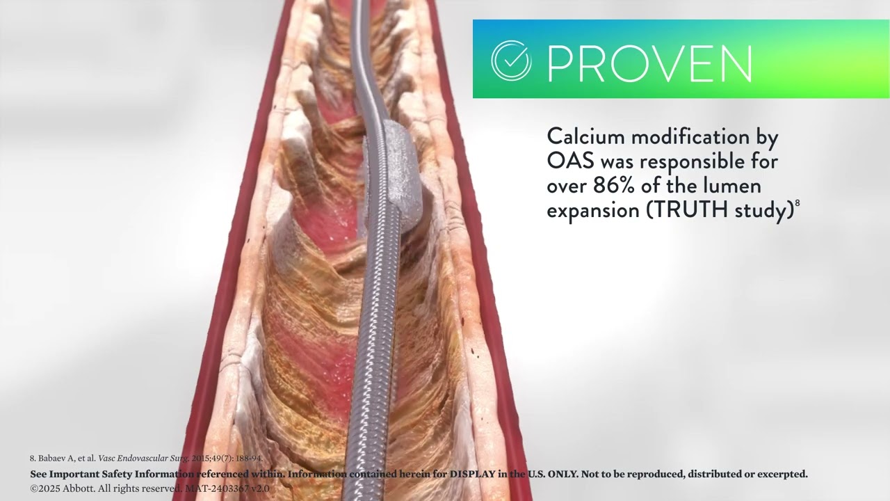 Diamondback 360™ Peripheral OAS Animation