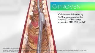 Diamondback 360™ Peripheral OAS Animation