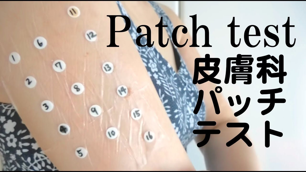 皮膚科のアレルギーパッチテスト🚑Patch test YouTube