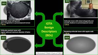 08 10 26 Samsung Classification of Ovarian Masses IOTA 2