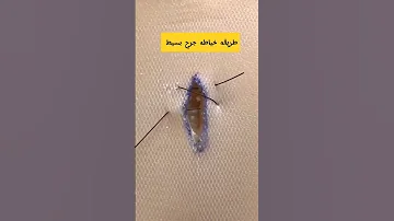 طريقه خياطه جرح صغير جرح خياطة جراحة التجميل غرزة تمريض طبيب Sutures 