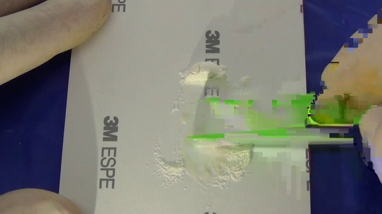 VÍDEO MANIPULACIÓN IONOMERO DE VIDRIO KETAC MOLAR PARA TÉCNICA ART.