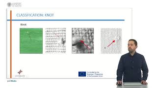 Celebrity Defects identification and classification | 83/87 | UPV Net Worth