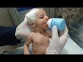Little baby not feeding 😔#babycare #neonatologist #babyfeeding #premature #miraclebaby #shorts 