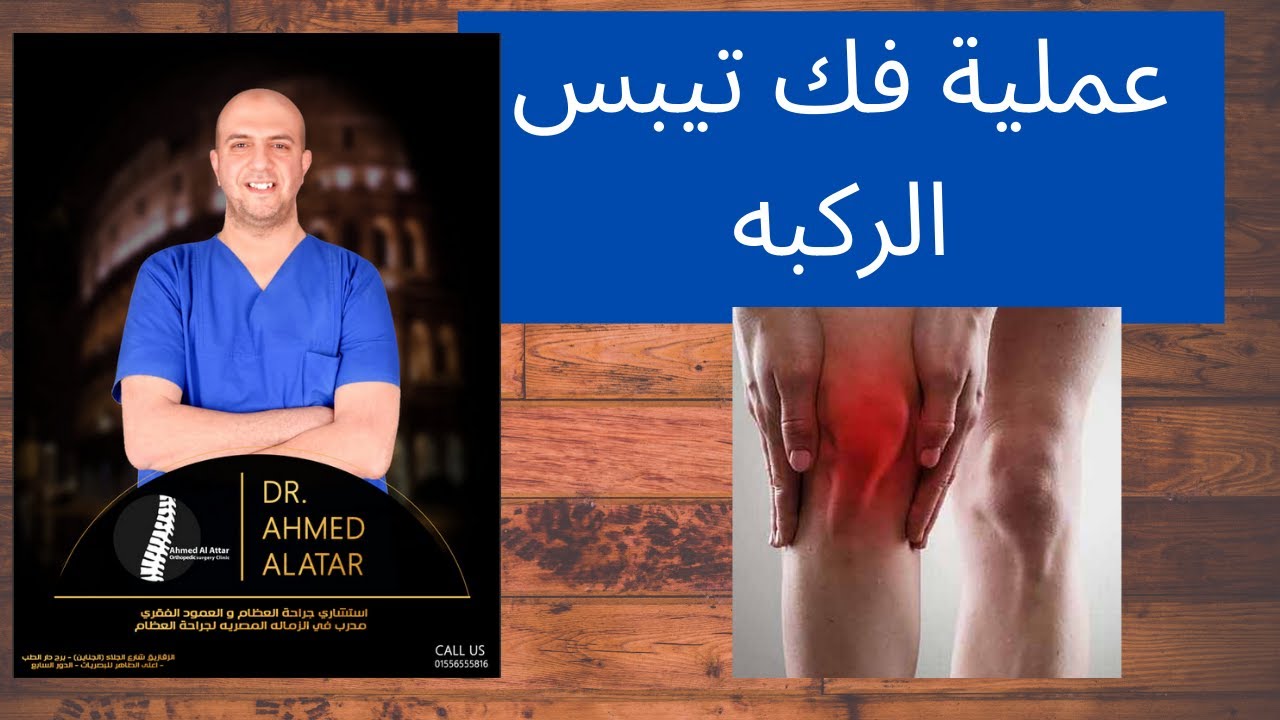 عمليه فك تيبس الركبه - د احمد العطار