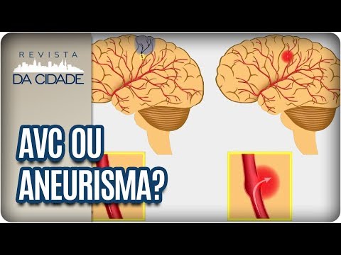 Vídeo: Diferença Entre AVC E Aneurisma