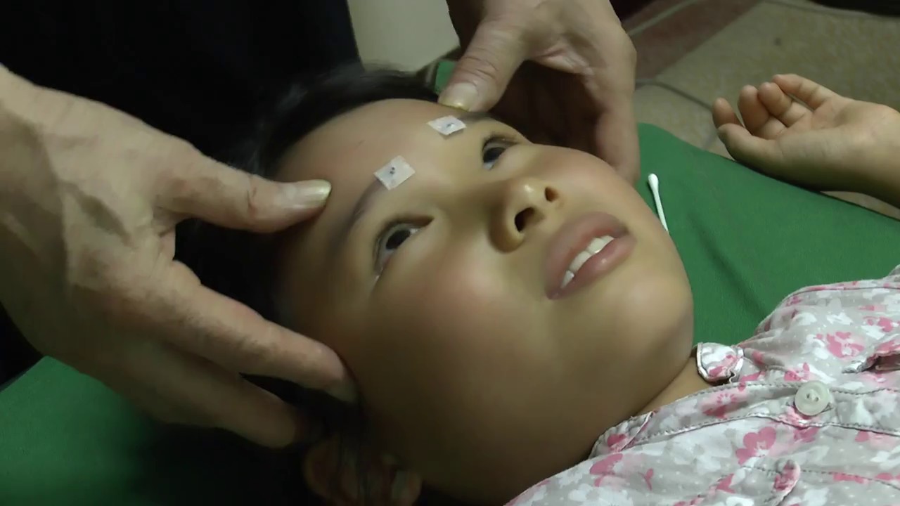 陽白穴按摩教學 - YouTube