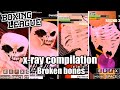 Boxing League, Compilation (Broken Bones) ROBLOX