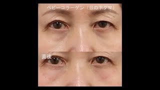 ベビーコラーゲンをおすすめする理由 東京新宿の美容整形ならもとび美容外科クリニック