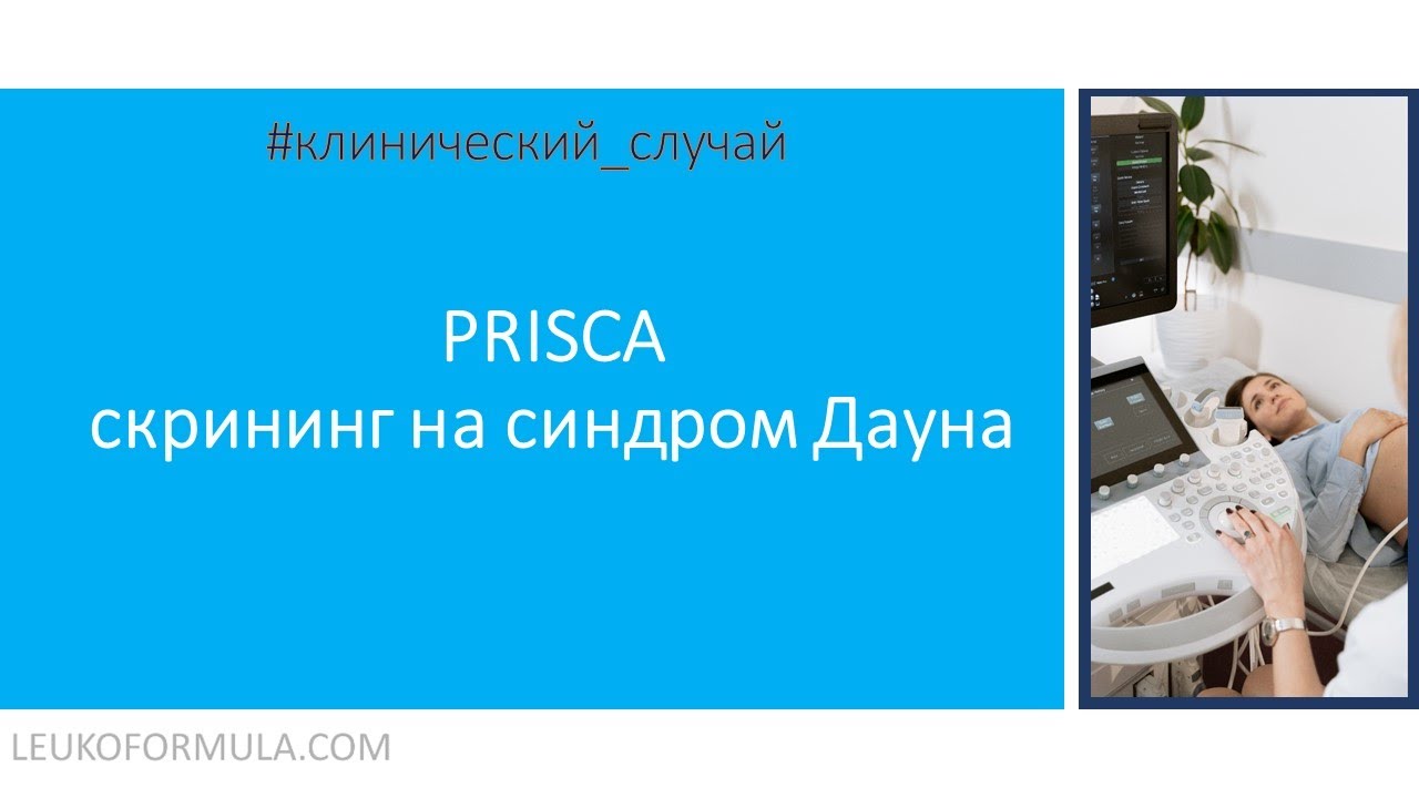 PRISCA - пренатальный скрининг I триместра. Интерпретация результата.