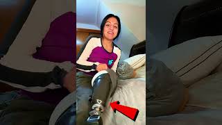 Celebrity Why does this happen in the leg? #interestingfacts Profile