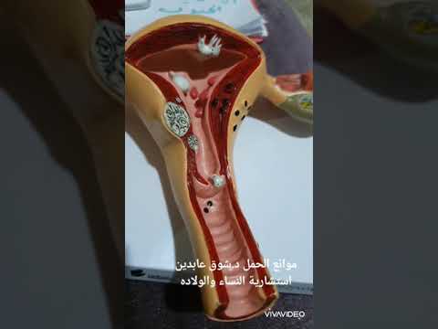 محاضره موانع الحمل د.شوق