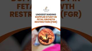 Doppler studies are an essential tool for tracking fetal growth