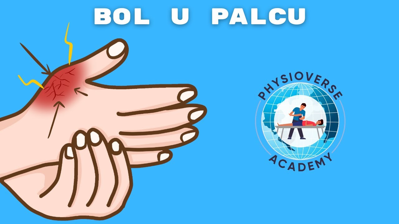 rije-ite-bol-u-palcu-u-3-minute-physioverse-academy-youtube