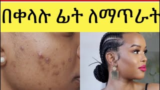 ለወዛም ፊት ለብጉር መከላከያ/oily face and acne prone skin