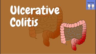 Ulcerative colitis [Pathophysiology, Gross & Microscopic morphology, Toxic megacolon]