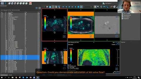 Webinar Medis Suite MR 3 2 New version including 4D Flow and more 2019