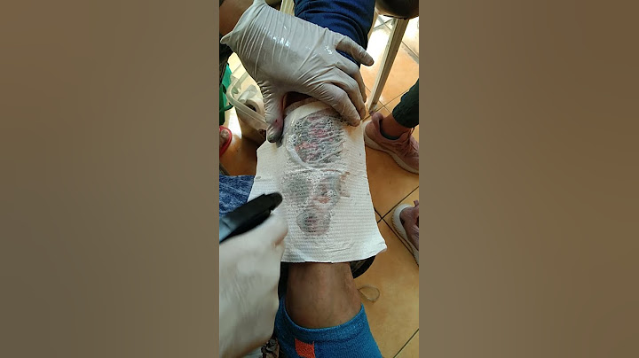 INKTOUCH