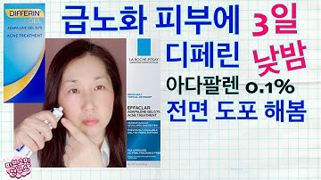 디페린 아다팔렌 0.1% 노화 피부에 아침 저녁으로 발라 봄??‍♀️폭망한 피부 살리기 3일 프로젝트 ?안티에이징 스킨케어