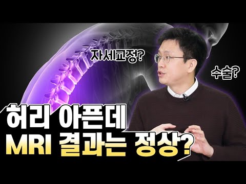 허리 통증의 원인과 척추 건강을 지키는 비법 알려줄게