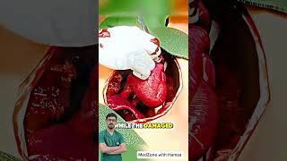Heart Transplant Surgery Explained Simply (3D Animation) | #hearttransplant #cardiacsurgery
