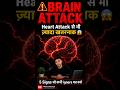 Brain Stroke — Heart Attack से भी तेज़ और खतरनाक 😱 | 5 Warning Signs #shorts