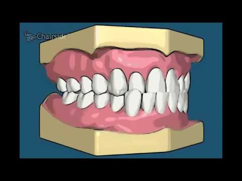 Ортодонтия Аномалии прикуса