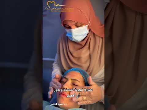 جلسة نظارة المشاهير بمجمع صحتي المتميز الطبي ليزميد تجميل مجمع صحتي