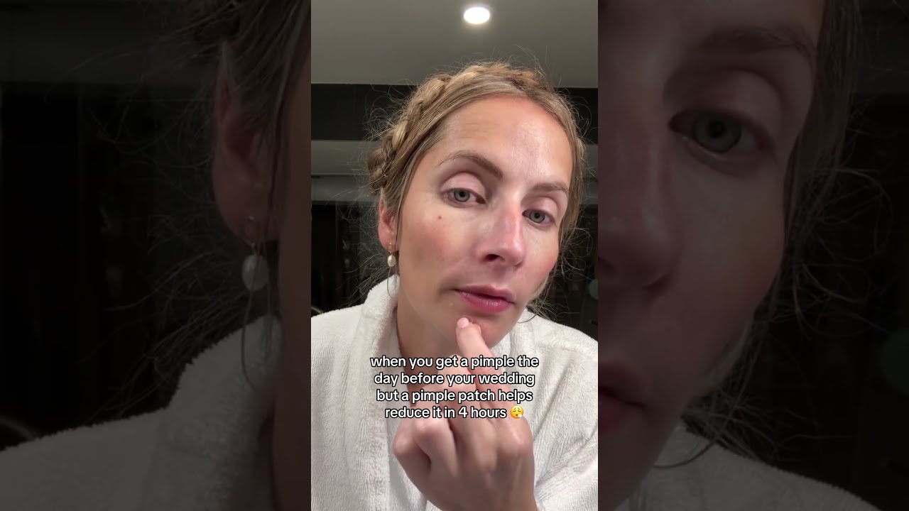Any Occasion Our Pimple Patches