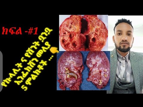 ቪዲዮ: CI እና ሲዲ ቧንቧ ምንድን ነው?