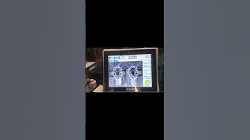 Mold protection vision system for the injection molding machine