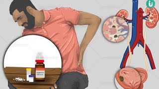 Kidney stone treatment is easy and that too at my clinic | Homeopathy Madicine
