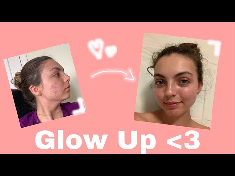 COMMENT J&rsquo;AI ÉLIMINÉ MON ACNÉ II SKINCARE ROUTINE :) *epiduo*