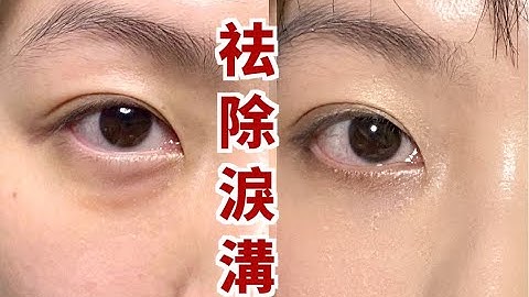 0成本按摩去淚溝眼袋 | 不醫美！告別遮瑕 日本爆火去淚溝按摩法來了